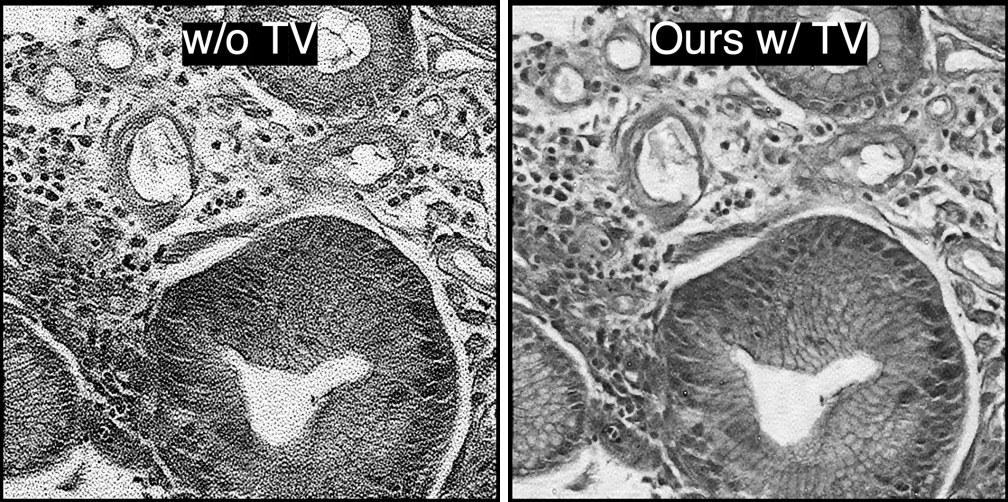 FP reconstruction of a tissue section from sparse, noisy measurements without (left) and with (right) the regularization.
