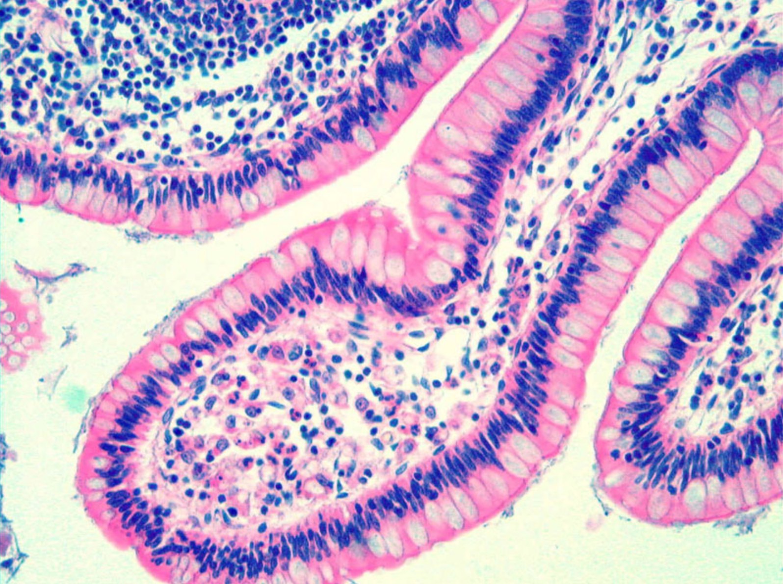 High-resolution FP image of an H&E-stained tissue section recovered with a low-magnification objective.