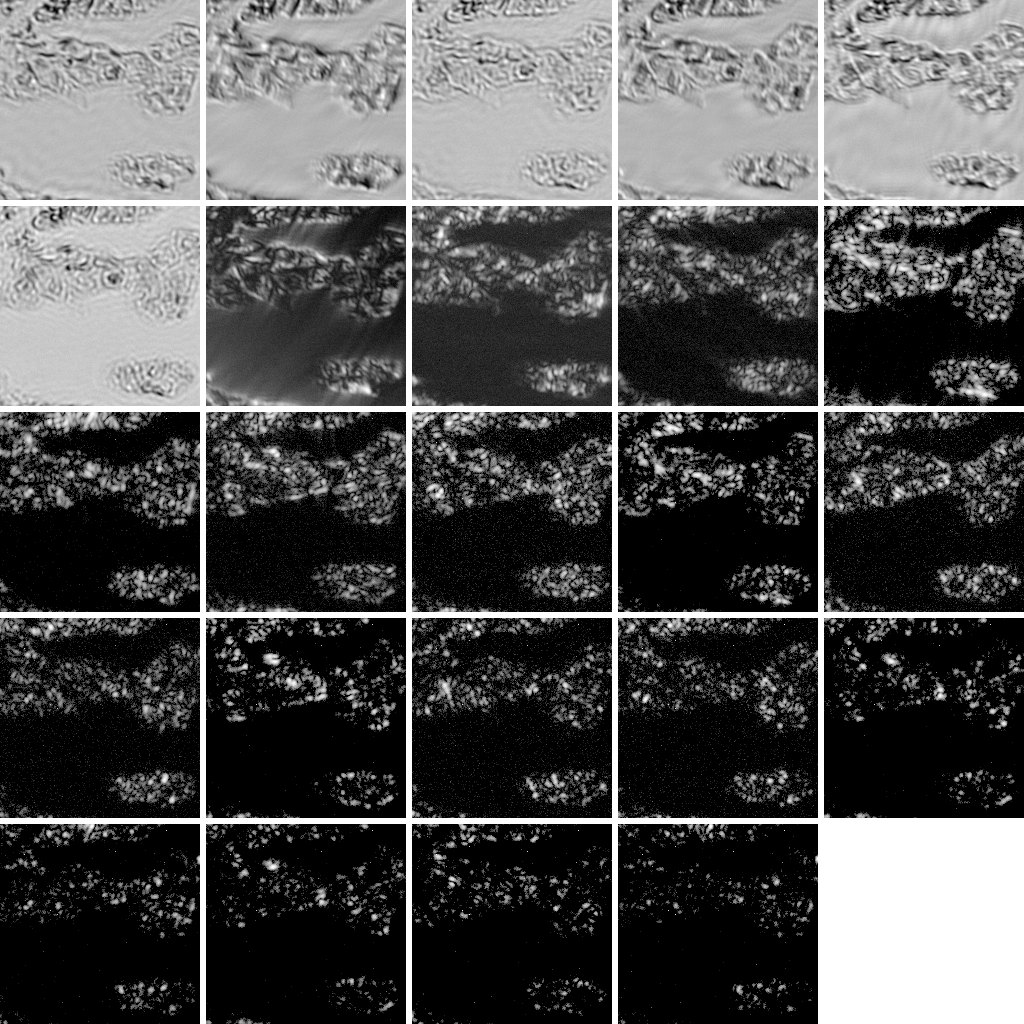 Raw low-resolution images of one tissue field under individual LEDs: bright-field frames (top) and dark-field frames (bottom), the input to FP reconstruction.