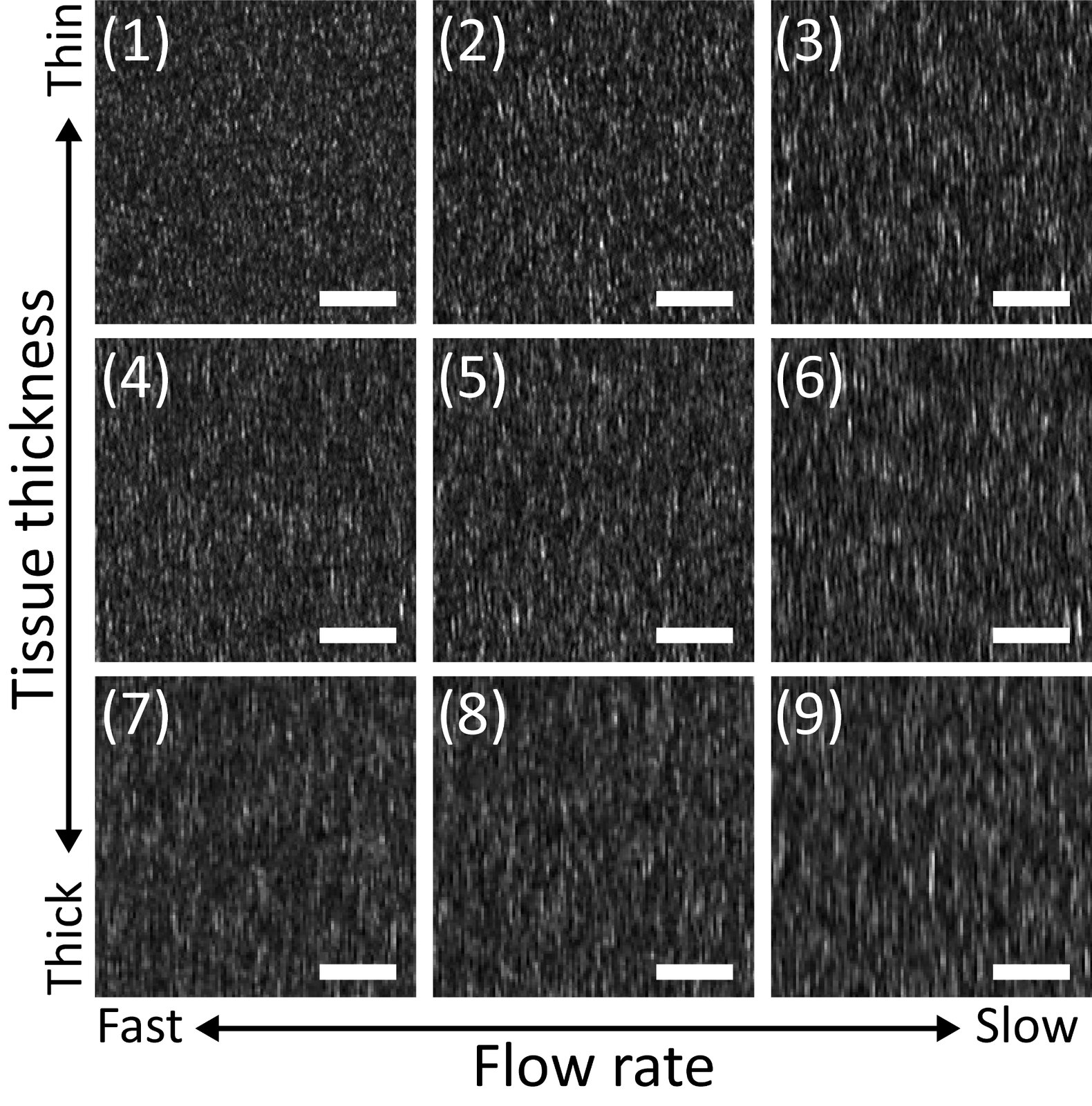 Rolling-shutter speckle images recorded at different flow rates and tissue-phantom thicknesses.