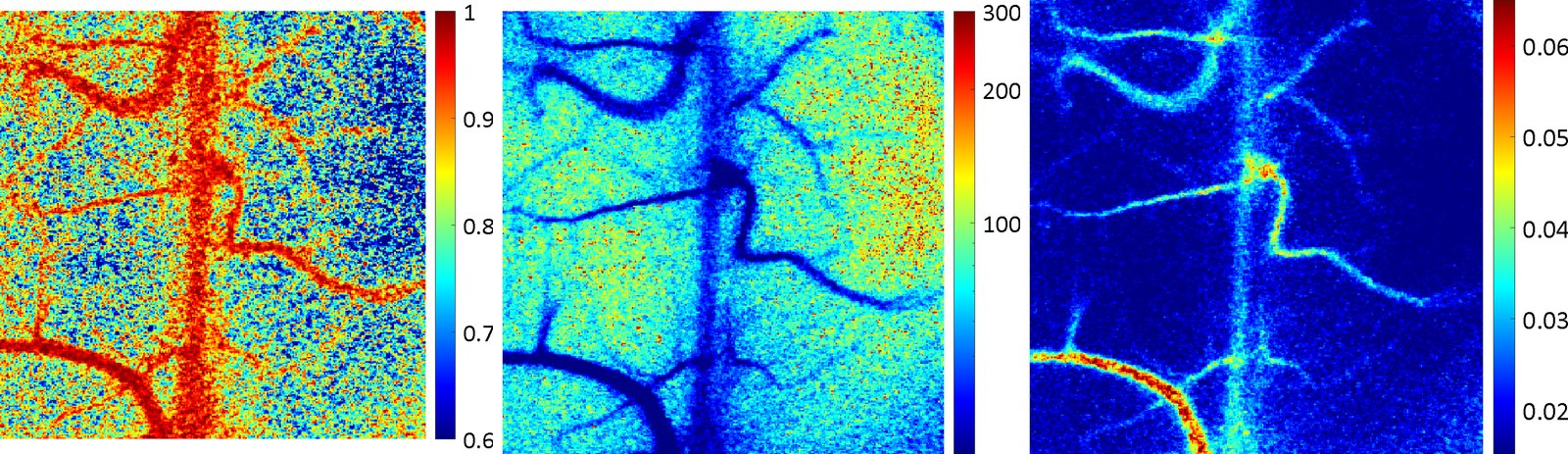 Mouse cortex through a cranial window imaged by rolling-shutter speckle imaging: static-scattering fraction, decorrelation time and blood-flow index maps.