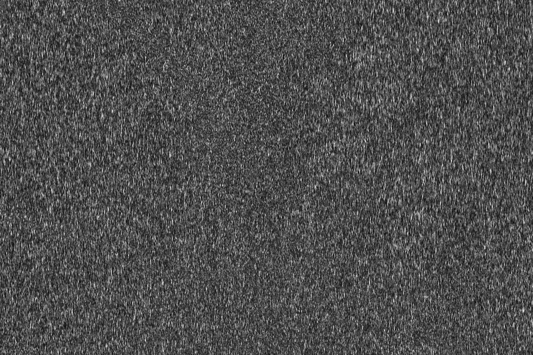 Part of a raw in vivo speckle frame from the public RSSI dataset (mouse brain 2).