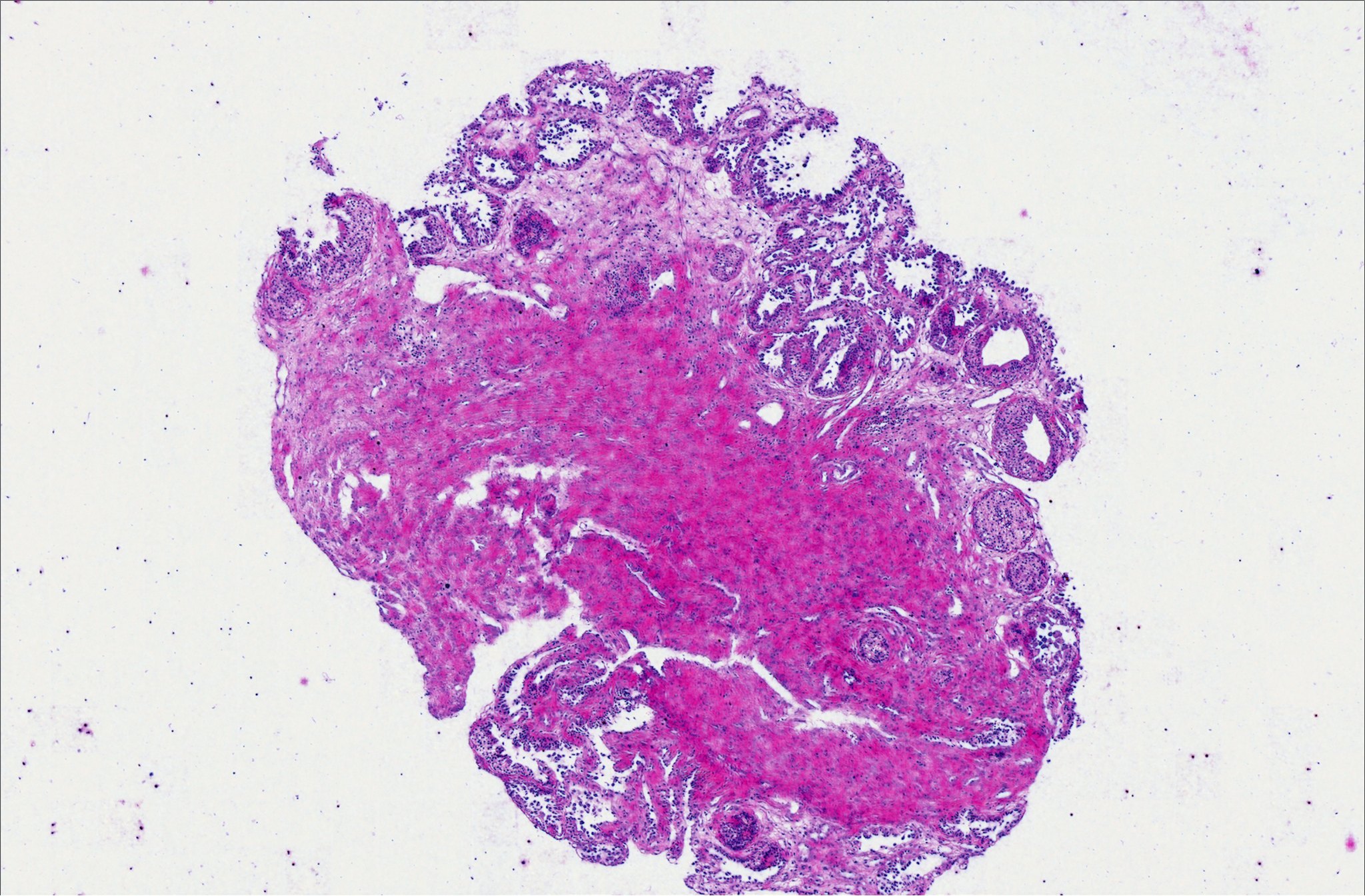 Archived urinary-bladder slide with faded H&E, virtually re-stained from its near-infrared phase image.