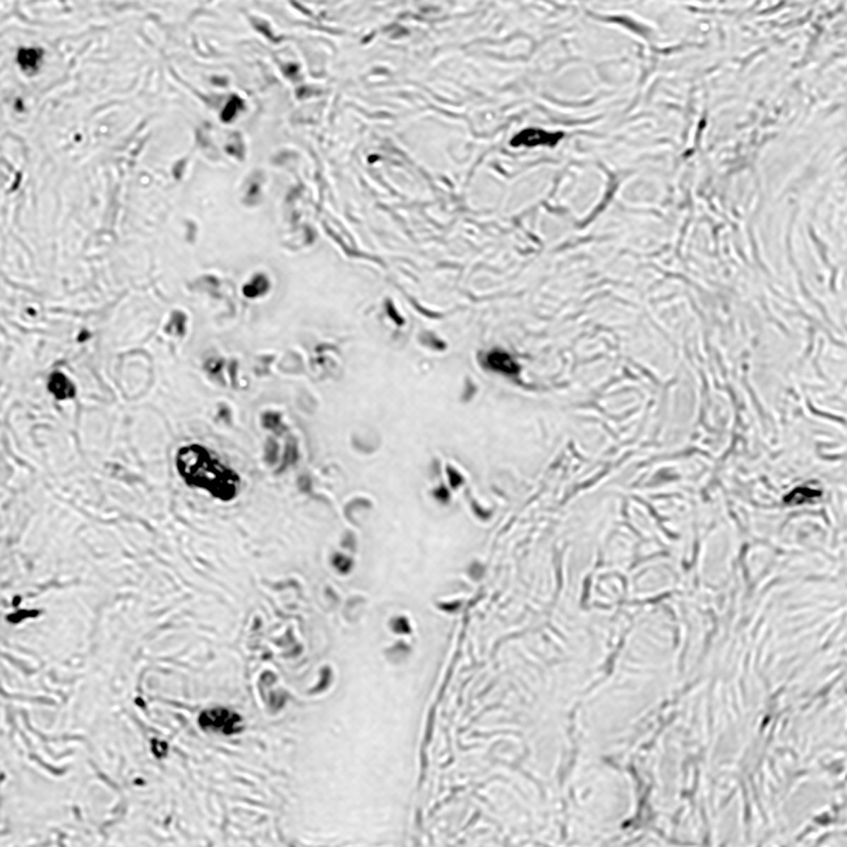 FP-reconstructed amplitude of an unstained tissue field from the FPVS example data.