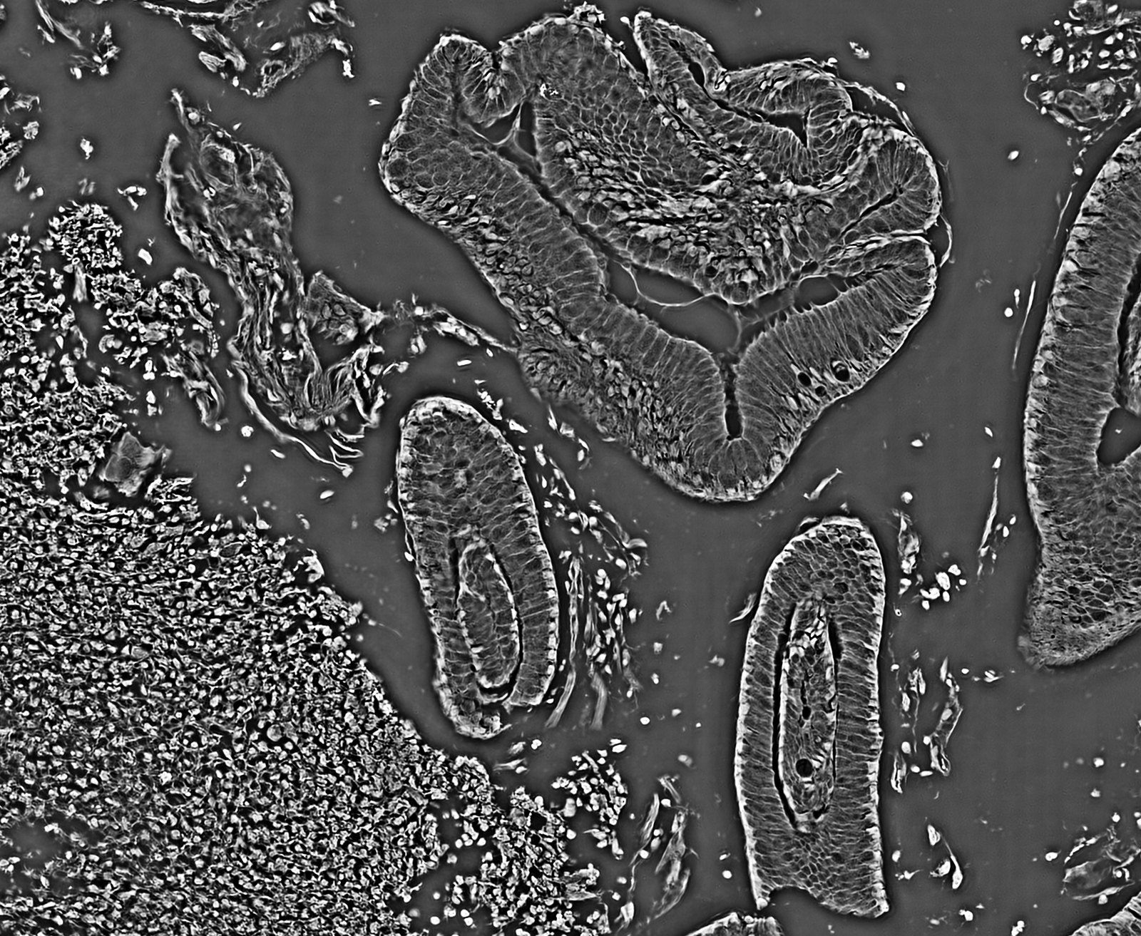 Quantitative phase image of an unstained tissue region with glands.