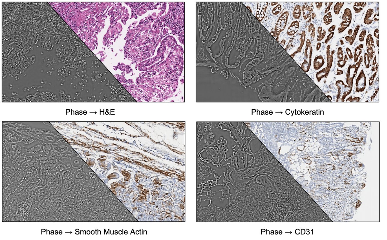 Label-free phase images split diagonally with virtual H&E and virtual immunohistochemistry.