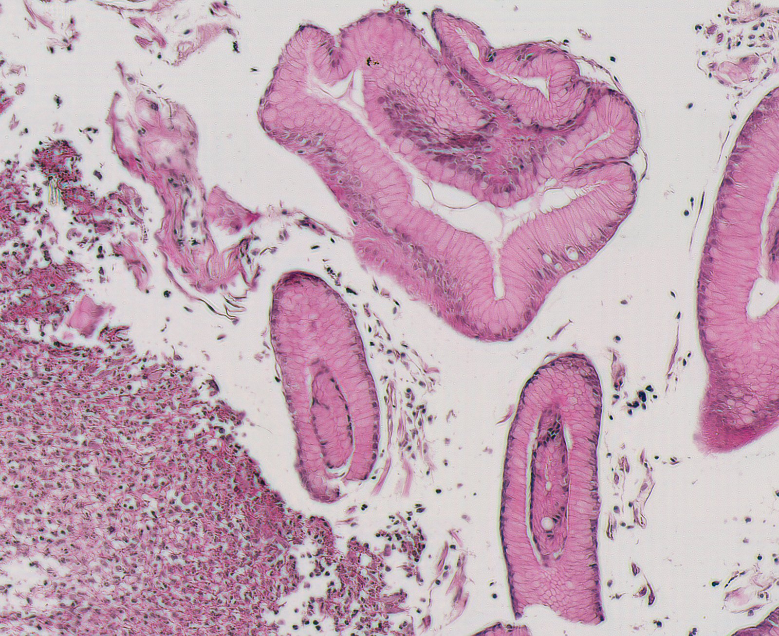Virtual H&E of the same region generated from the phase image.