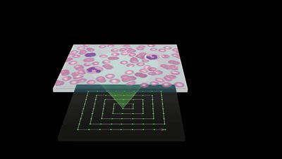 A blood-smear slide placed on an OLED display; single display pixels light the sample along a spiral scan.