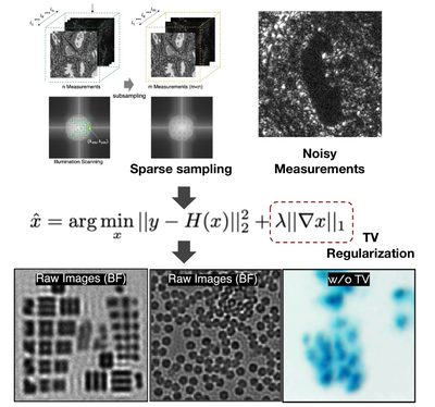 FP from fewer and noisier measurements: reconstructions with and without anisotropic TV regularization.