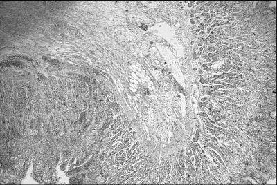 Raw tissue image recorded under a learned multiplexed LED pattern, the network input.