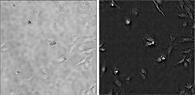 The same unstained cells in a raw low-resolution bright-field image (left) and in the FP quantitative phase image (right).
