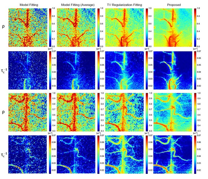 Mouse cortex maps from pixel-wise fitting, averaged fitting, TV-regularized fitting and a physics-constrained network.