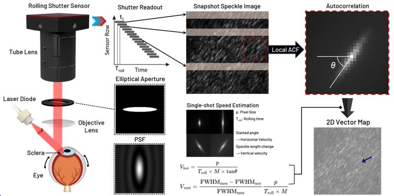 Speckle-based eye-movement tracking: a rolling-shutter sensor with an elliptical aperture views laser speckle on the sclera; slanted speckles encode eye velocity.