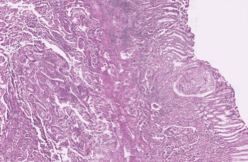 Whole-slide virtual H&E generated from a label-free FP phase image by unsupervised edge-guided virtual staining.
