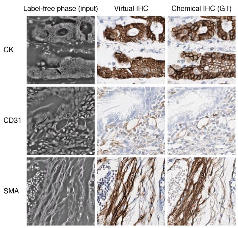 Virtual immunohistochemistry from label-free phase compared with chemical IHC.